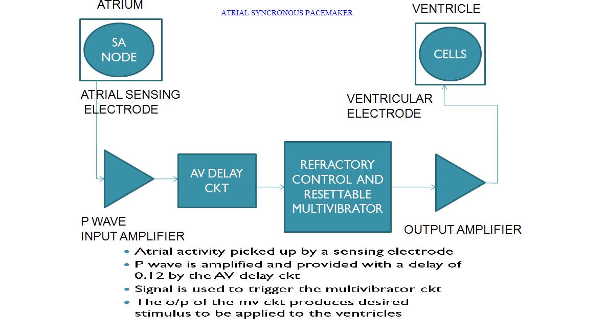 ATRIAL_pace.JPG