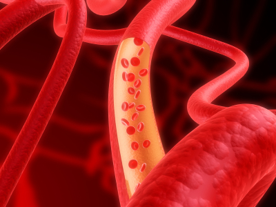 blood-vessels.jpeg